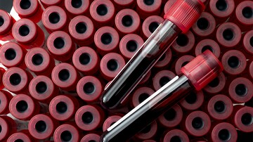 Greater Triglyceride-Glucose Index Variability Tied to CV Risk	