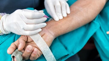 Distal Radial Snuffbox Technique Comes Up Short in DISCO-RADIAL 