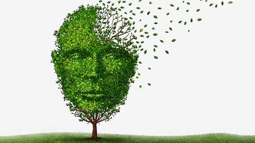 Many Americans Missing an Opportunity to Prevent Dementia