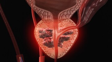 Prostate Cancer Survival: Enzalutamide Edges Out Abiraterone