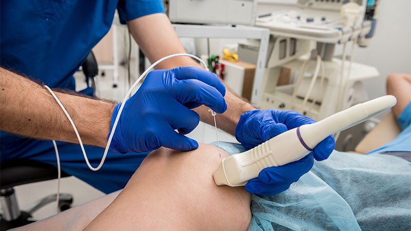 AF Pulsed-Field Ablation Meets Pivotal Safety, Efficacy Goals