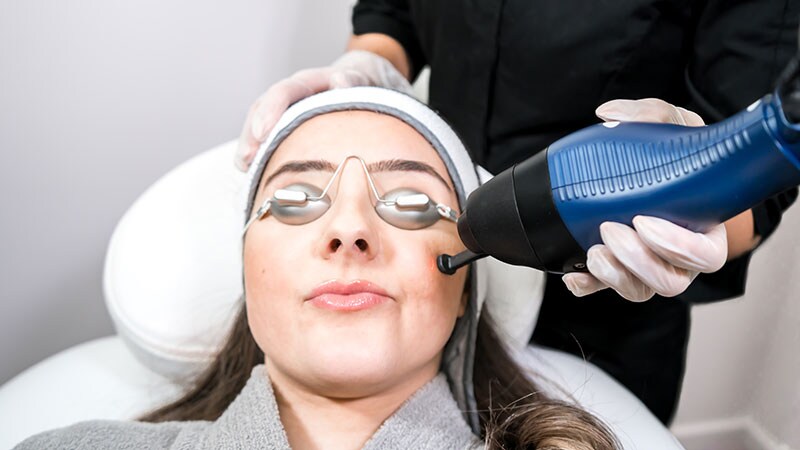 Study Looks at Fractional Resurfacing Laser Complications