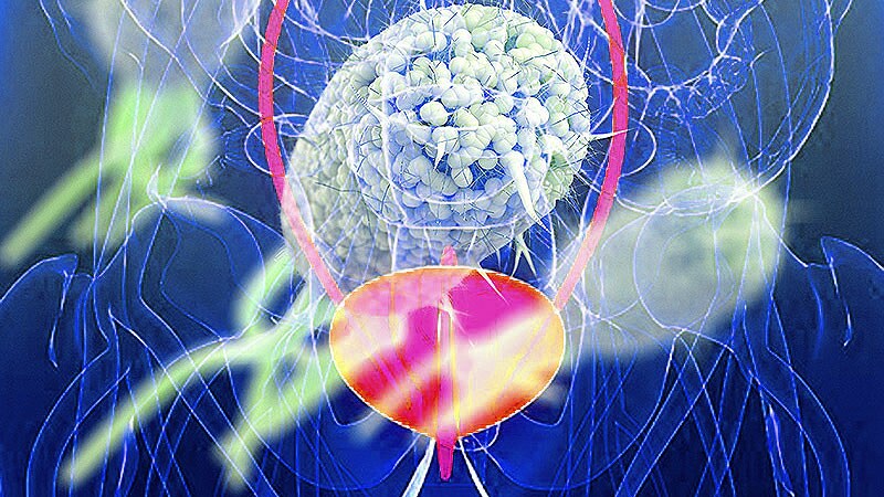 UTI Imaging Falls Short in Some Primary Care Settings