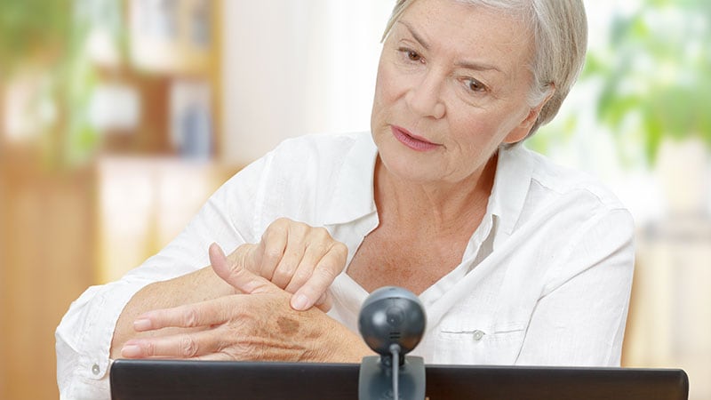 Patients Surveyed on Post-Mohs Surgery Teledermatology Visit