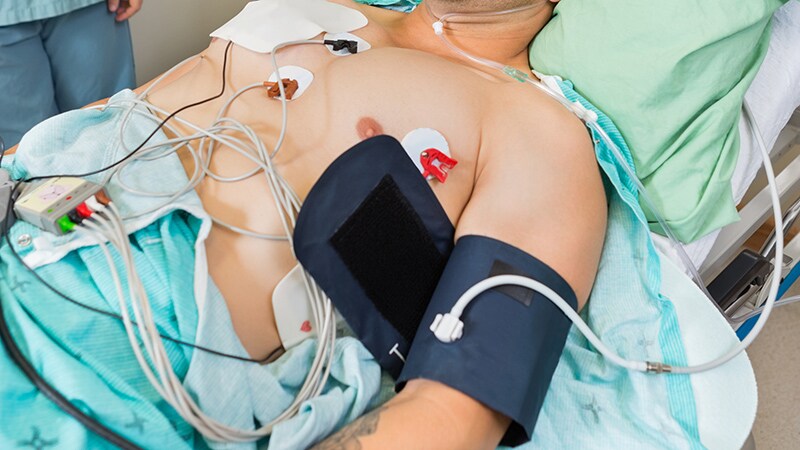 ECG Monitor Implant Tightens AF Management, Boosts Outcomes