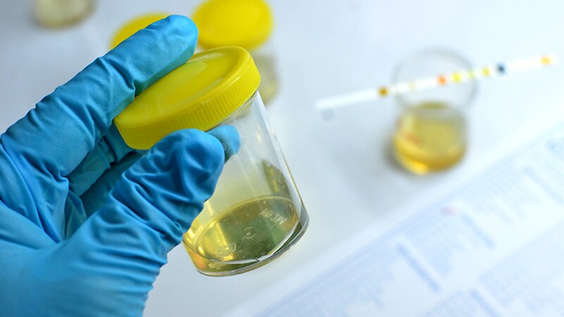 Big Boost in Sodium Excretion With HF Diuretic Protocol 