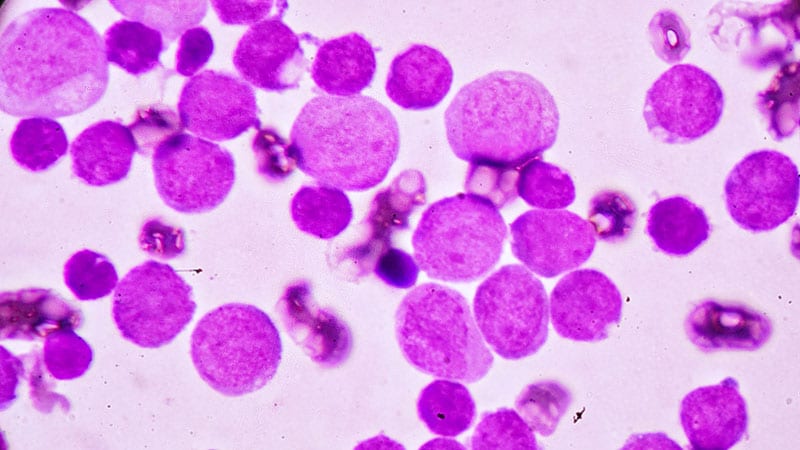 Fast Five Quiz: Acute Myeloid Leukemia Practice Essentials