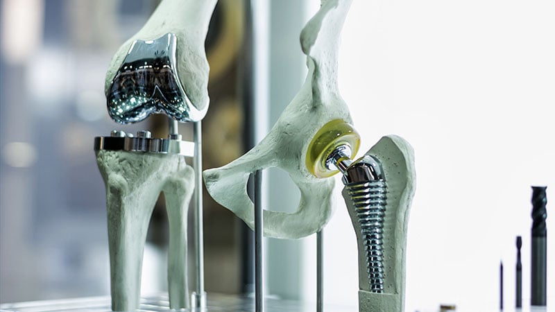 All in Stride: Few Age Limitations for Joint Replacement