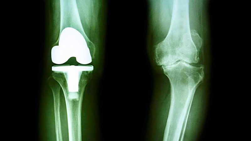 Does Continuity of Care Affect Outcomes After Arthroplasty?