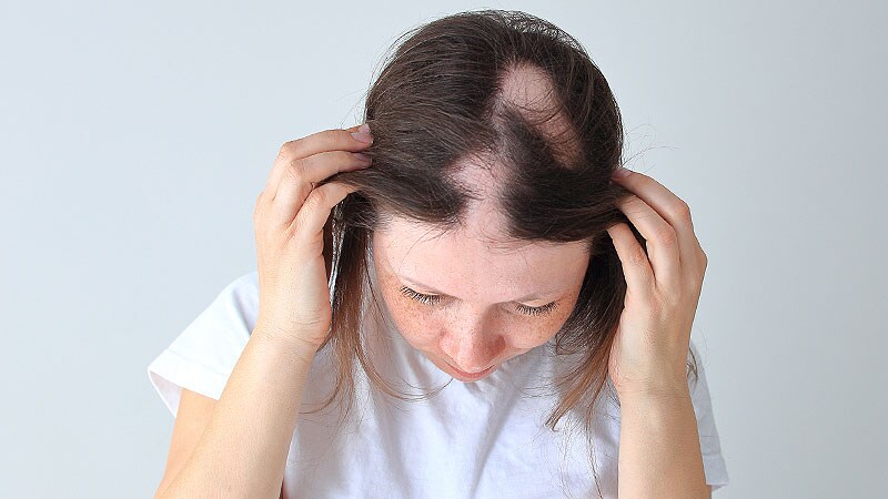 Topical Botanical Drug Coacillium Curbs Childhood Alopecia