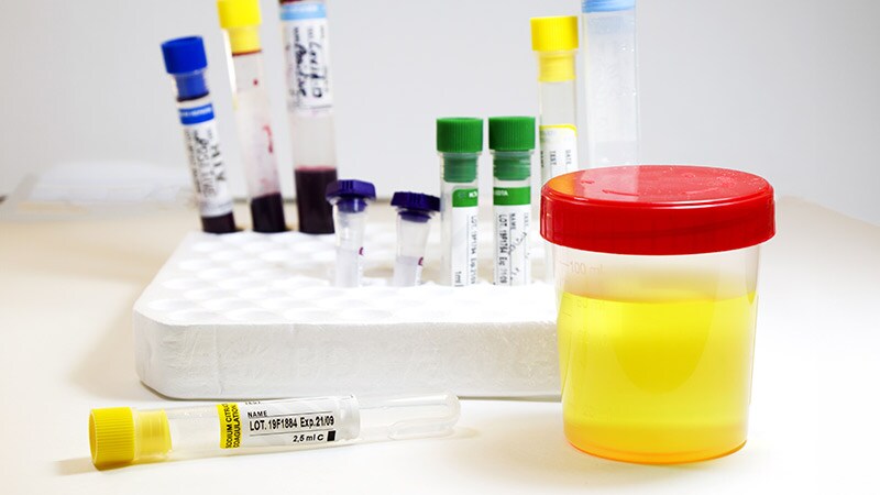 COVID Linked With Urologic Effects in Men