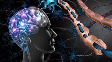 Rapid Review Quiz: Multiple Sclerosis Risk Factors 