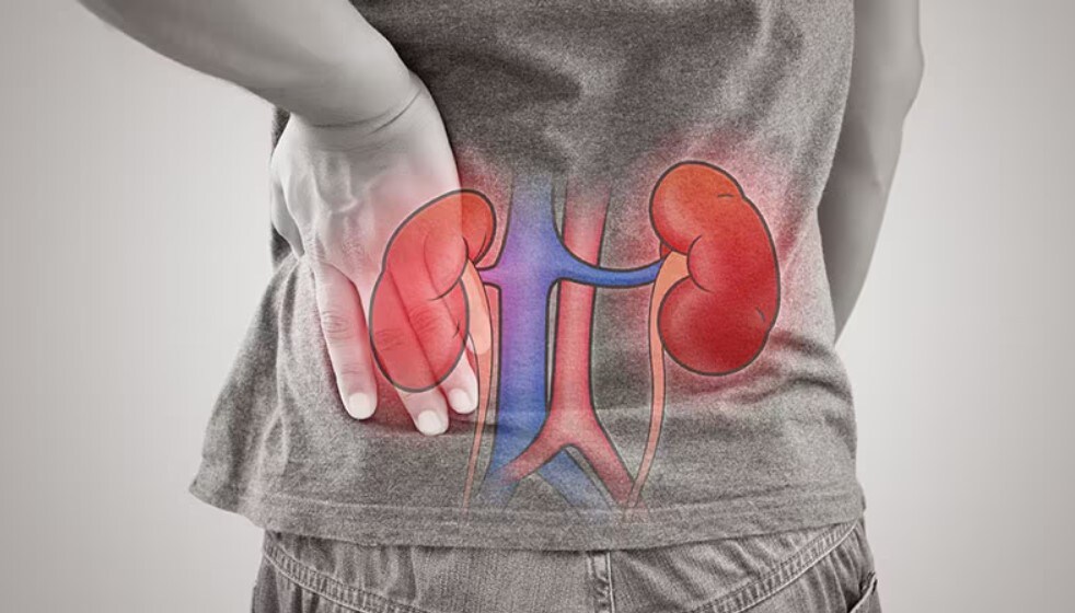 Fast Five Quiz: The Nuances of Acute Kidney Injury