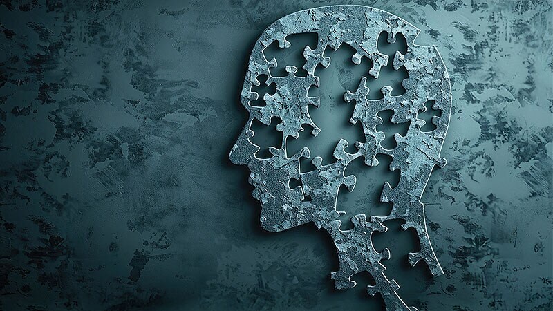 Rapid Rx Quiz: Alzheimer’s Disease Treatment