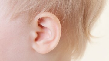 Ear Tubes No Better Than Antibiotics for Otitis Media