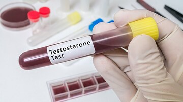 Lower Testosterone in Men Tied to Severe COVID Cases