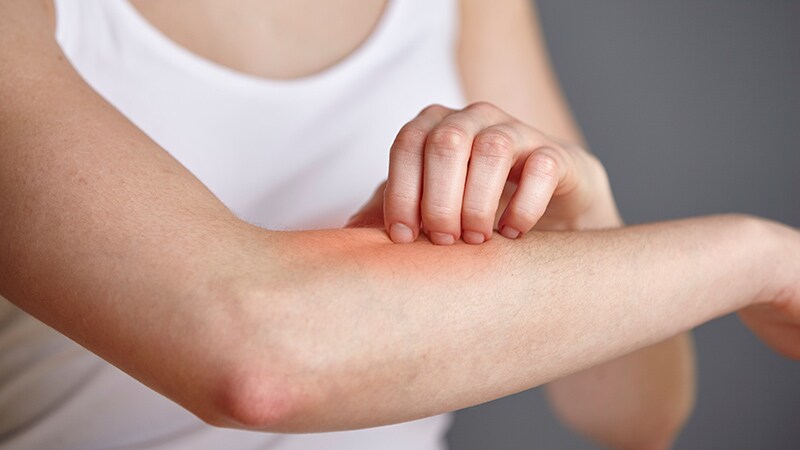 Autoinflammatory Diseases 'Not So Rare After All,' Expert Says