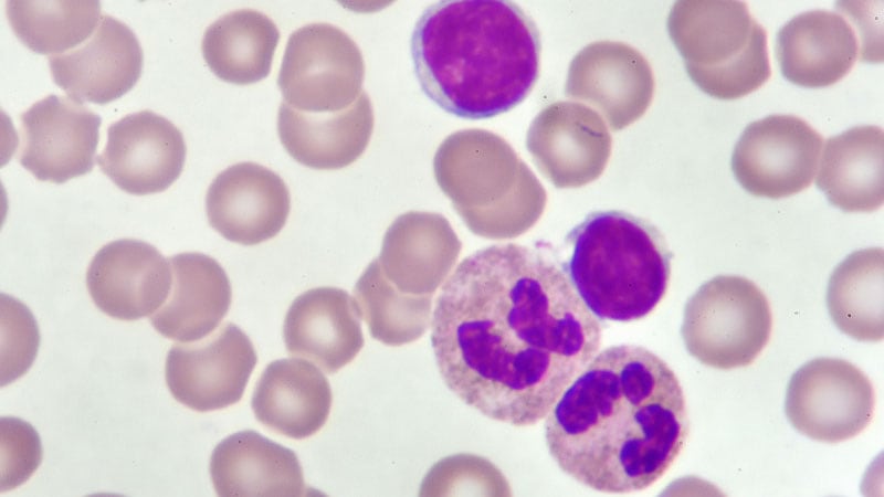 'Promising' New Txs for Most Common Adult Leukemia