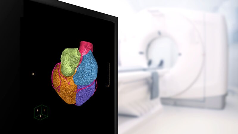Real-World Data Favor Invasive Strategy for NSTEMI With CKD