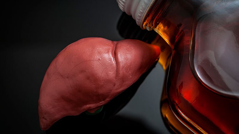 Two-Pronged Approach Needed in Alcohol-Associated Hepatitis