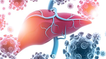 Newly Defined Liver Disorder Associated With COVID Mortality