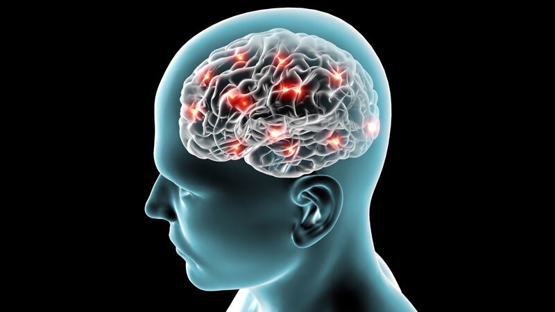 Nonmotor Seizures Delay Diagnosis of Focal Epilepsy