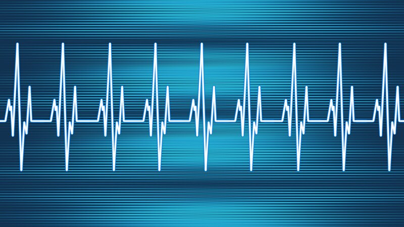 For Antiseizure Med: Don't Panic but Beware of Cardiac Risks