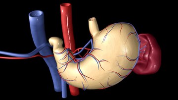 Lap Band Failures Drive Many to Safer Weight Loss Surgeries