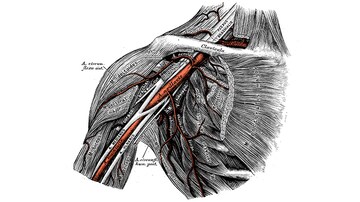 First-Ever Best Practices for Percutaneous Axillary Access