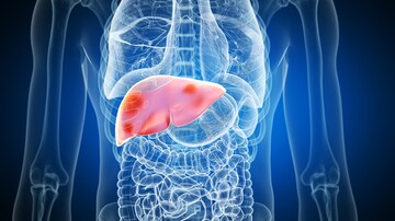 'Forever Chemicals' Linked to Liver Damage