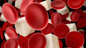 Exenatide Linked to Less Hyperglycemia After Stroke