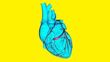 Noninvasive Approach to Revascularization Decisions Shows Promise
