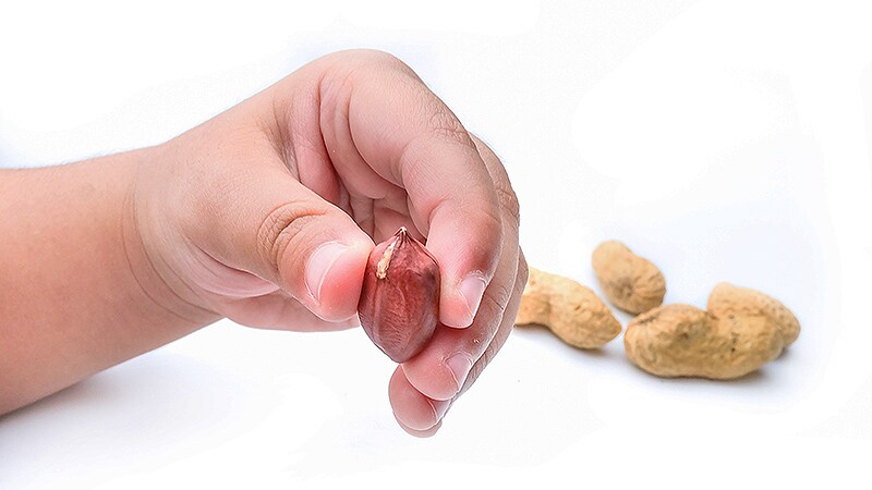 Epicutaneous Immunotherapy Helps Young Peanut-Allergic Children