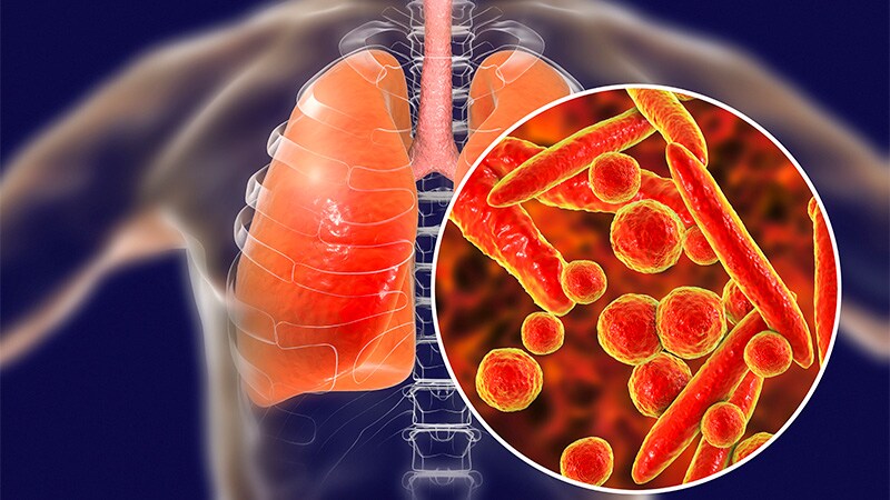 Clinical Characteristics of Recurrent RIME Identified in Study