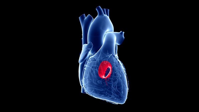 Fourth-Gen Transcatheter Mitral Valve Shows Improvements