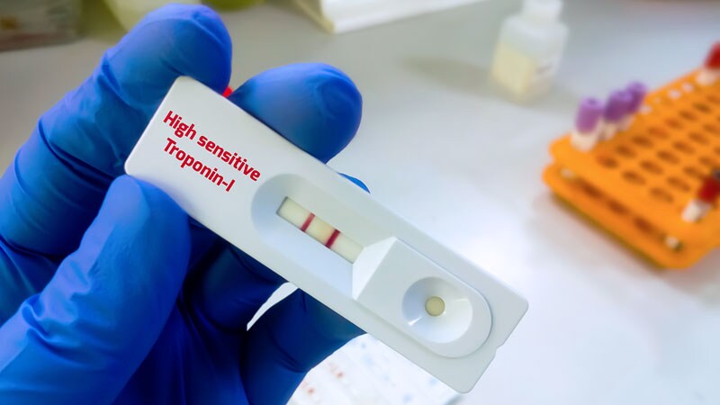 Uptake of High-Sensitivity Troponin Assays Lags in US Hospitals