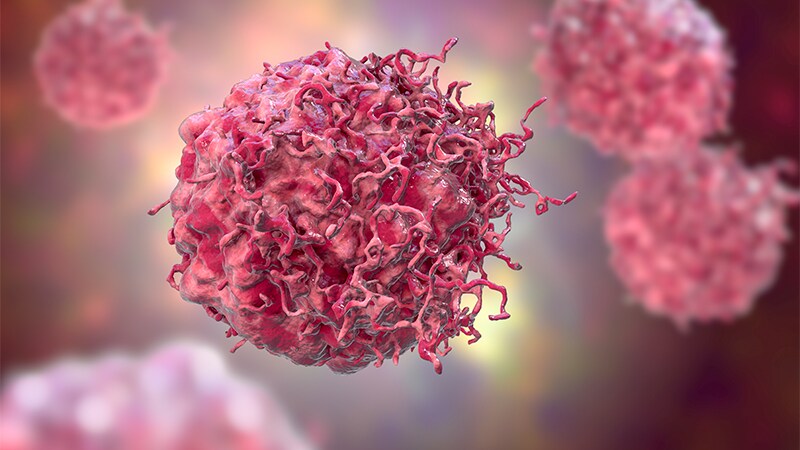 Rapid Review Quiz: Obesity – Therapeutics and Cancer Risk