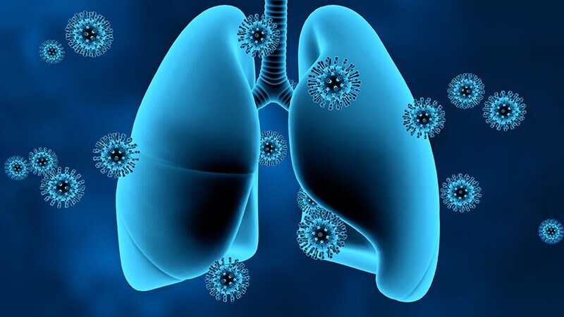FREEDOM COVID: Full-Dose Anticoagulation Cut Mortality