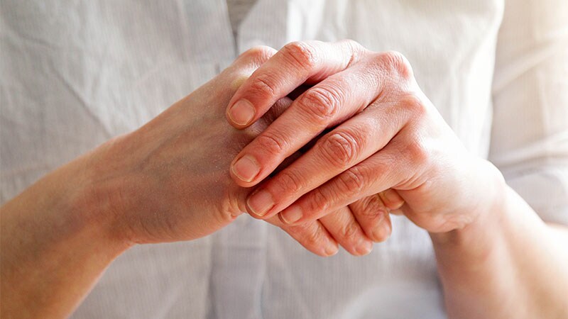 Topical Delgocitinib Effective for Hand Eczema in Phase 3 Trial