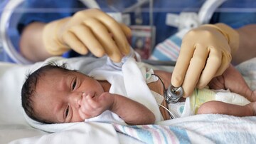 AHA, AAP Update Neonatal Resuscitation Guidelines