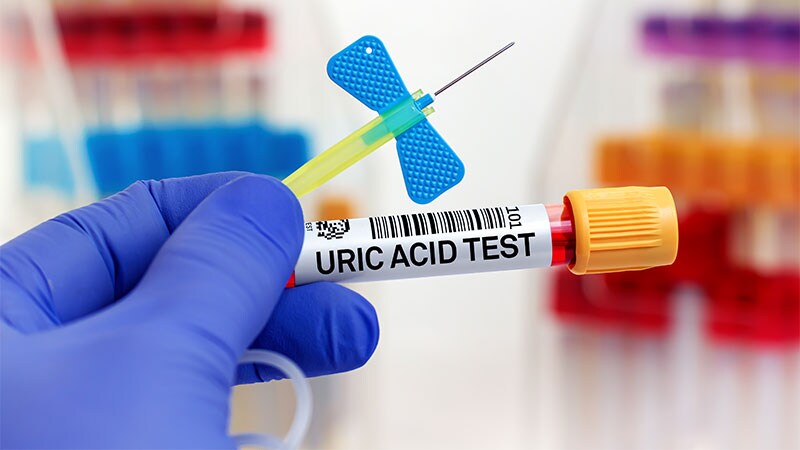 URAT1 Inhibitor Shows 'Substantial' Cut in Uric Acid in Gout