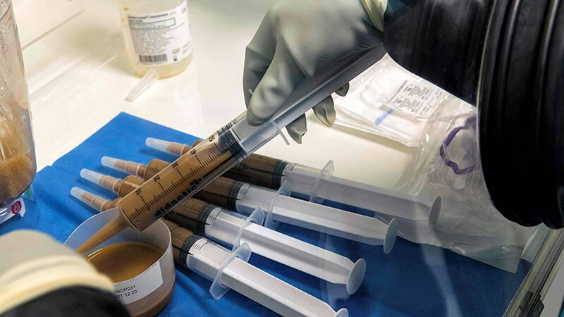 FMT Modifies Gut Microbiome, Reduces Ammonia in Cirrhosis 