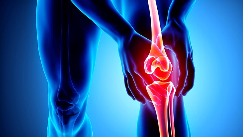 Calcium Crystal Deposition in Knee OA: What Is Its Impact?