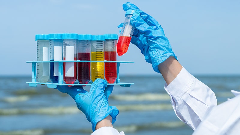 Wastewater Signals Upswing in Flu, RSV