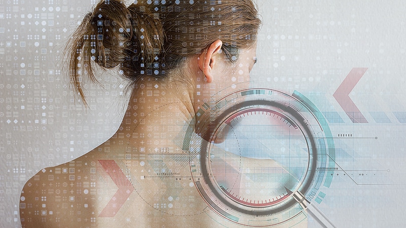 AI Can Flag Skin Cancer With Near-Perfect Accuracy