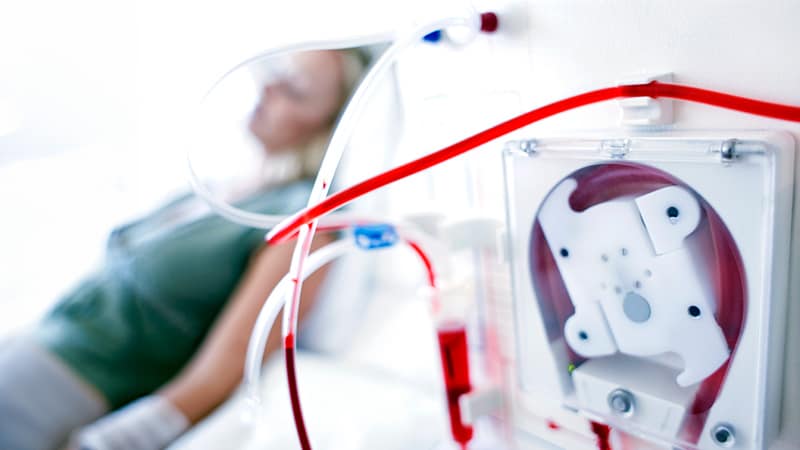 New Calculator Tool Estimates Fracture Risk on Dialysis