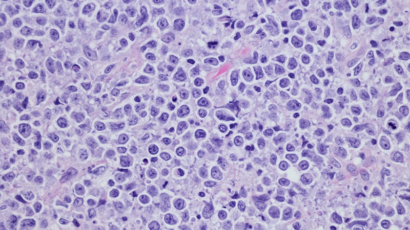 Misdiagnoses Among Challenges in Managing Cutaneous Lymphoma