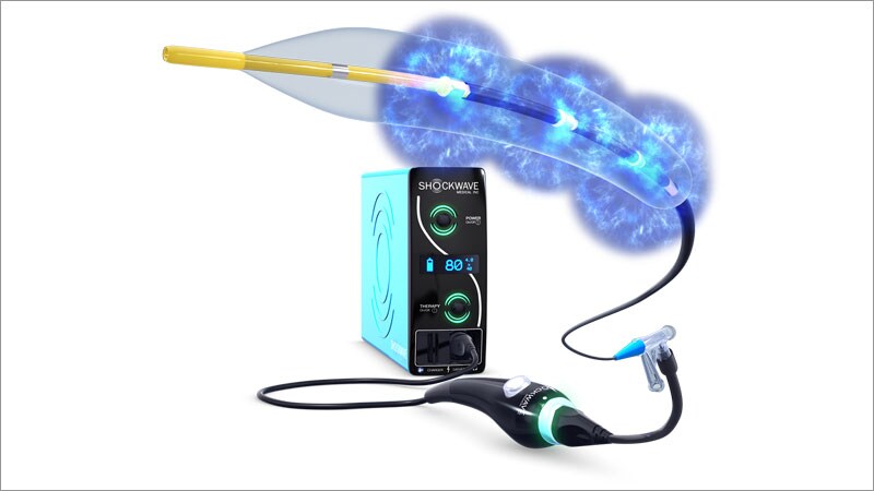 TCT Intravascular Lithotripsy Hailed for Coronary Calcification