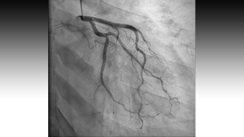 35-Year-Old With Confusion and Headache