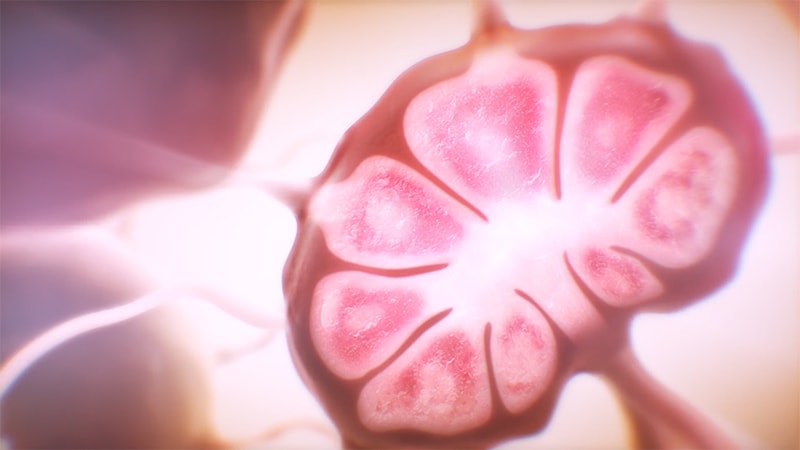 Steroids Increase Infection Risk With CAR T-Cell Therapy in NHL